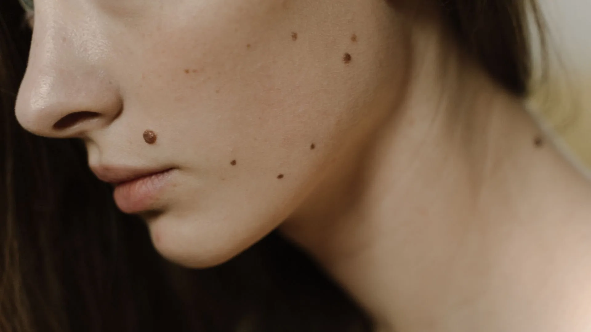 Moles on your face and their meaning